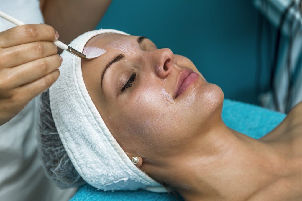 Benefits of Chemical Peel