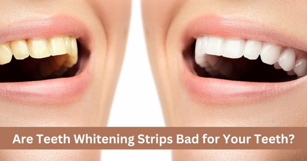 Are Teeth Whitening Strips Bad for Your Teeth?