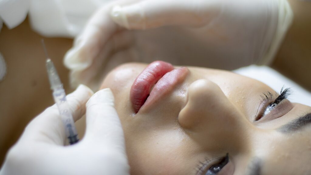 Myths About Lip Fillers Debunked