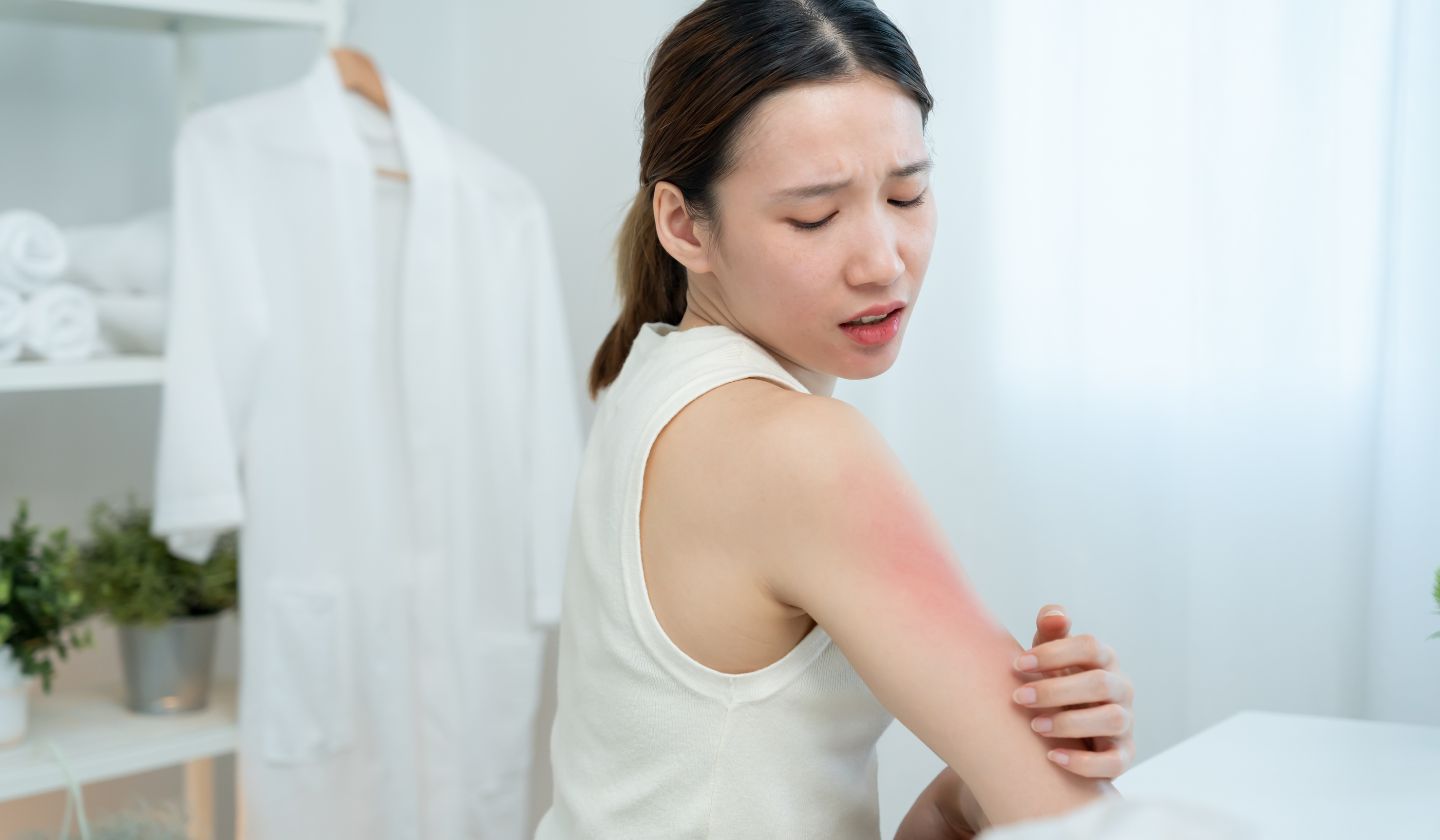 Caring for Teenage Skin