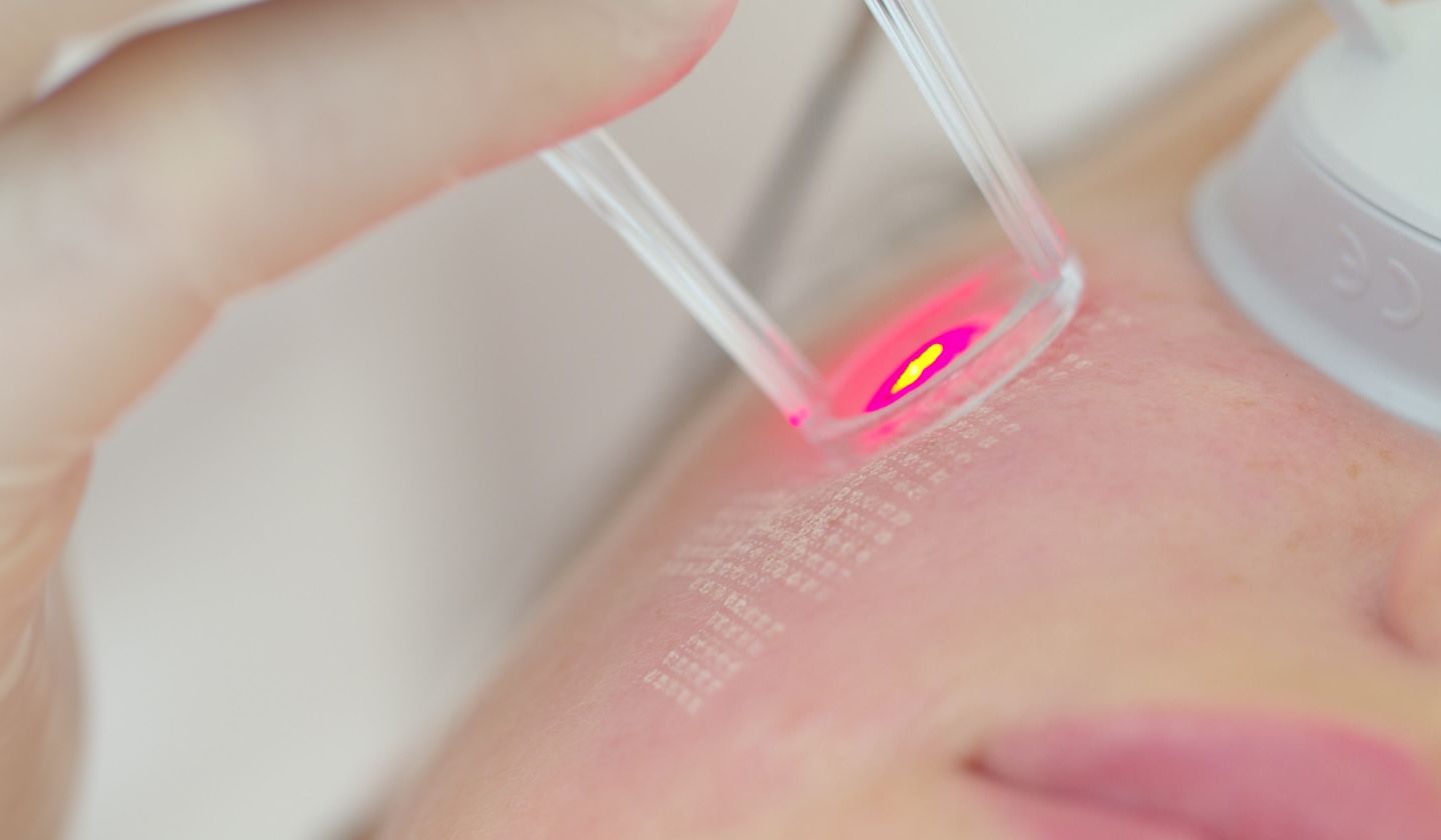 Laser Skin Resurfacing Hurt