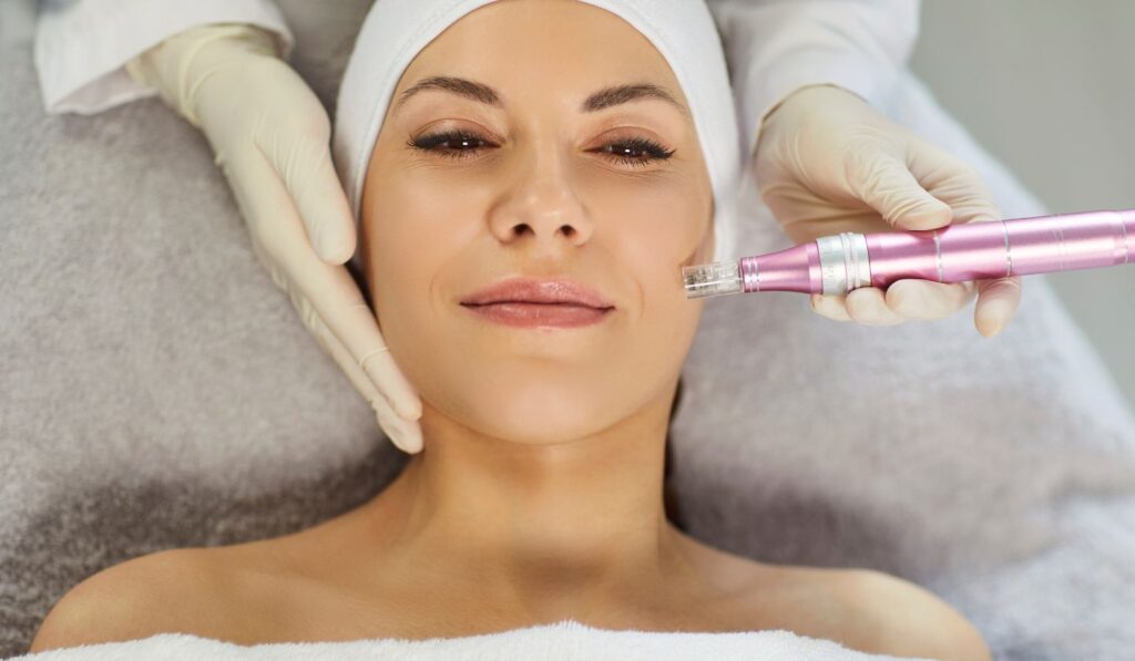 Exosome Microneedling