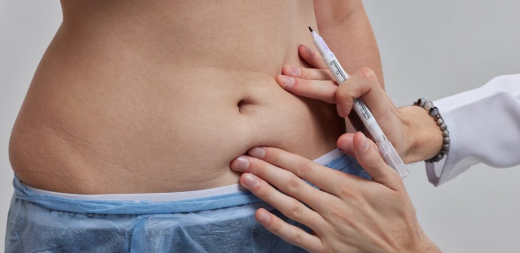 Can You Combine Weight Loss Injections With Body Sculpting