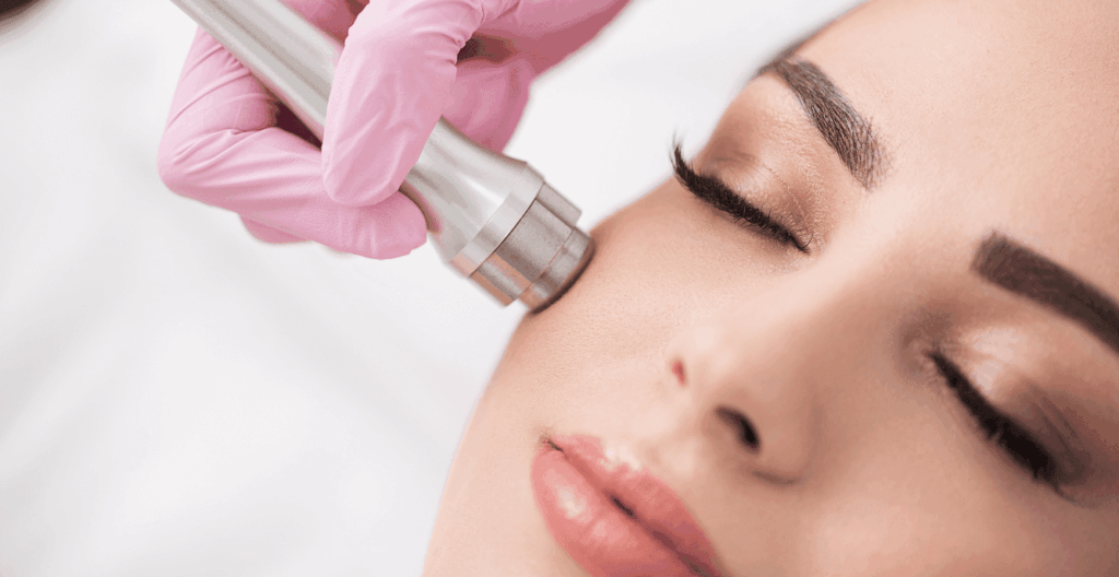 Does Microneedling Really Tighten Skin