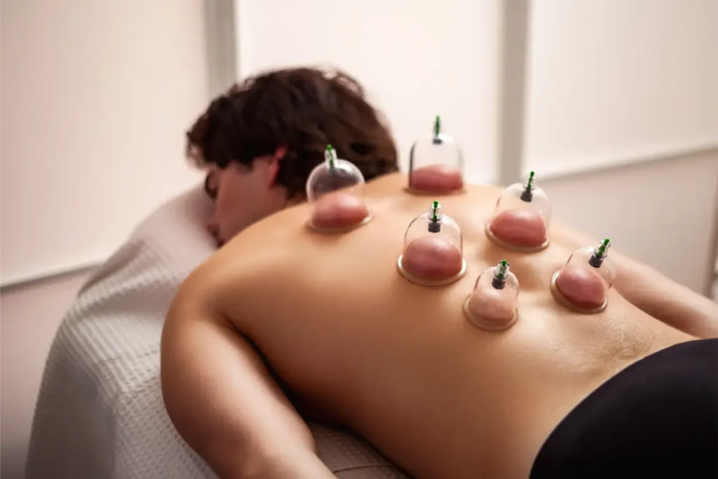 What Are The Benefits Of Cupping Massage