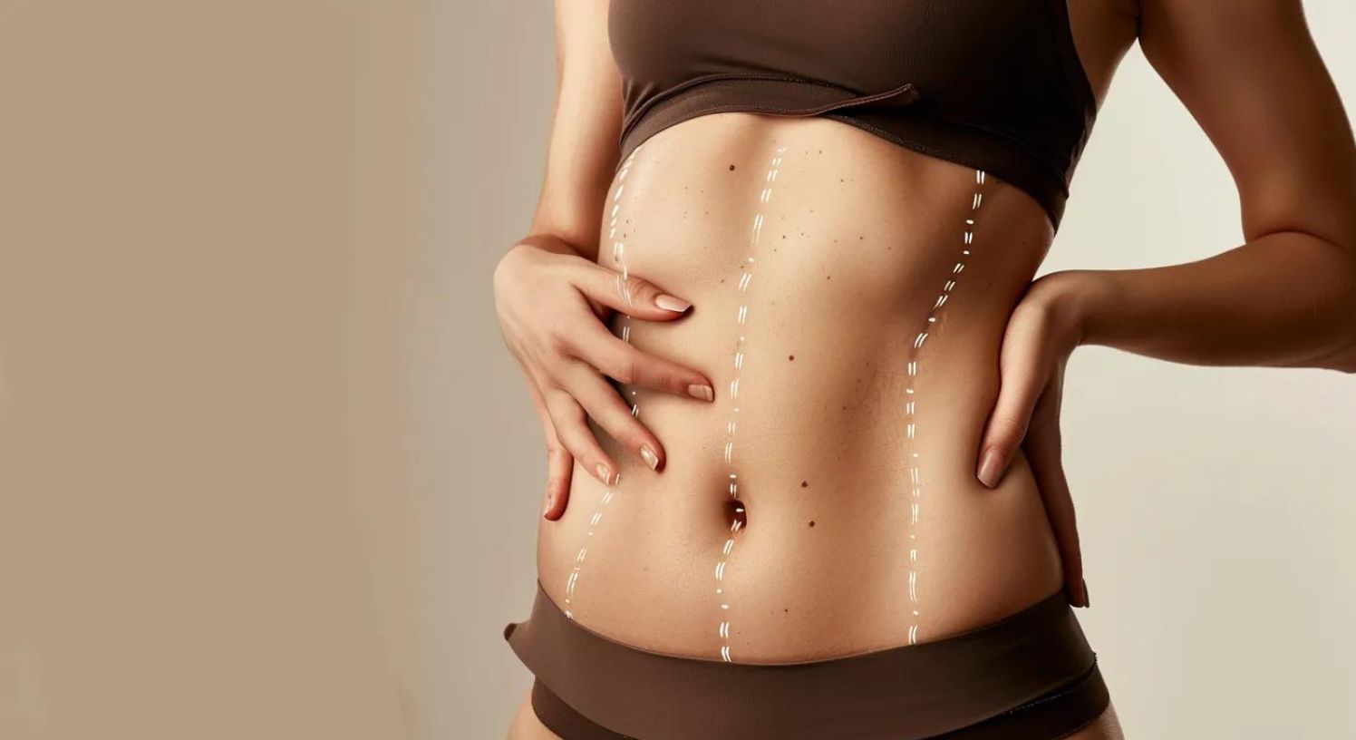 Energy Based Technologies in Body Contouring