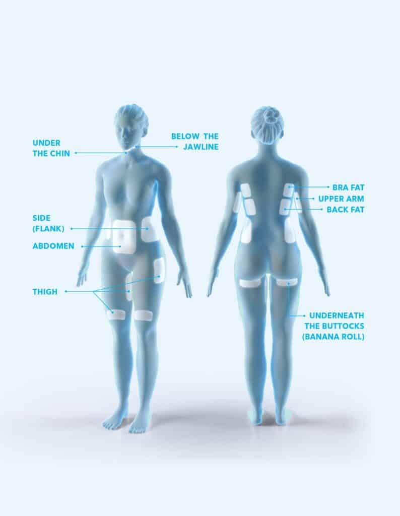 Fat distribution and targeted reduction strategies